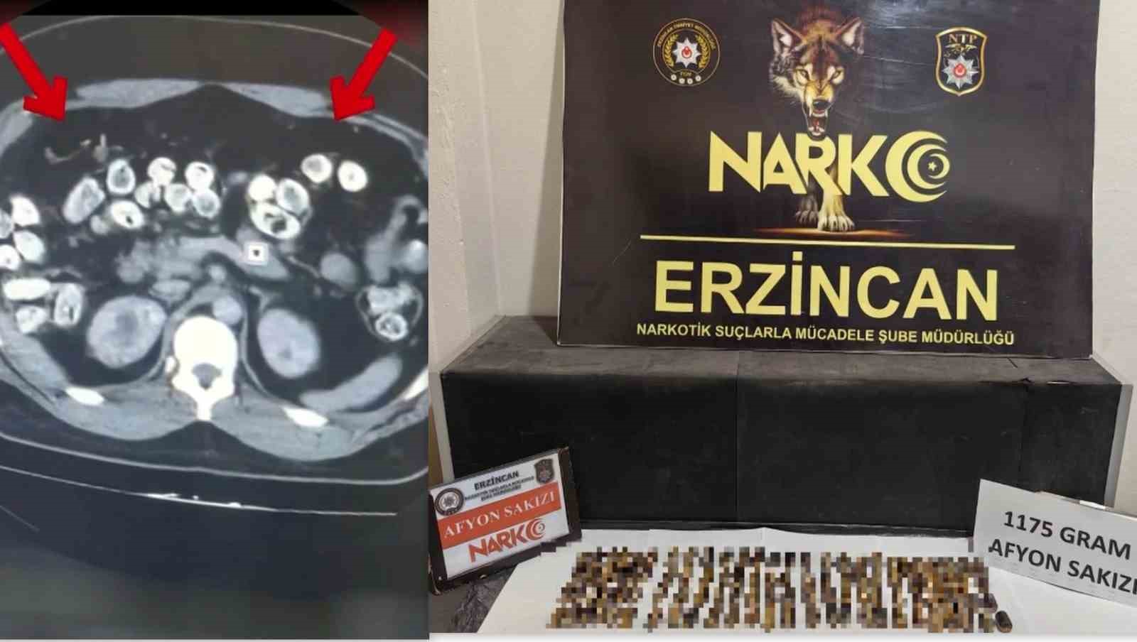ERZİNCAN'DA MİDE VE BAĞIRSAKLARINDA KAPSÜL HALİNDE UYUŞTURUCU BULUNAN 3 ŞÜPHELİ TUTUKLANDI
