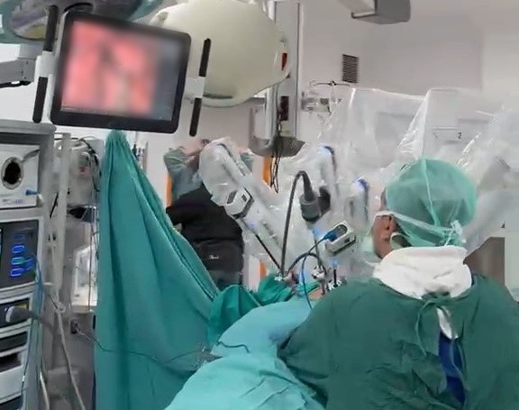 ONDOKUZ MAYIS ÜNİVERSİTESİ (OMÜ) TIP FAKÜLTESİ HASTANESİ'NDE GÖĞÜS CERRAHİSİ ALANINDA KARADENİZ BÖLGESİ'NDE İLK ROBOTİK AKCİĞER AMELİYATI YAPILDI.